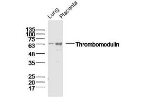 Lane 1: Lung lysates Lane 2: Placenta lysates probed with Thrombomodulin Polyclonal Antibody, Unconjugated  at 1:300 dilution and 4˚C overnight incubation. (Thrombomodulin Antikörper  (AA 21-120))