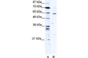 WB Suggested Anti-PDLIM5 Antibody Titration:  1. (PDLIM5 Antikörper  (Middle Region))