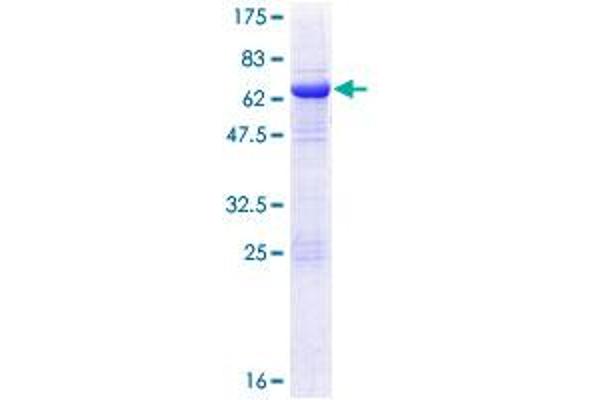 Eukaryotic Translation Initiation Factor 3, Subunit M (EIF3M) (AA 1-374) protein (GST tag)