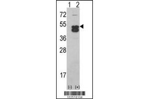 Western blot analysis of CAMK1D using CAMK1D (CAMK1 delta)Antibody using 293 cell lysates (2 ug/lane) either nontransfected (Lane 1) or transiently transfected with the CAMK1D gene (Lane 2). (CAMK1D Antikörper  (C-Term))