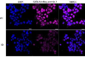 Immunocytochemical staining of HeLa cells using GATA binding protein 3 antibody (ABIN7798695), 1:1,000), Top panel: wild-type (WT), Bottom panal: GATA binding protein 3 shRNA knockdown (KD).