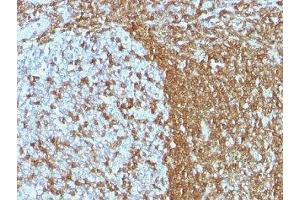 Formalin-fixed, paraffin-embedded human tonsil stained with ICAM3 antibody (ICAM3/1019) (ICAM-3/CD50 Antikörper)