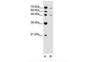 Image no. 1 for anti-Zinc Finger, FYVE Domain Containing 27 (ZFYVE27) (C-Term) antibody (ABIN205048)