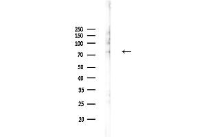 anti-Acyl-CoA Synthetase Long-Chain Family Member 5 (ACSL5) (N-Term) antibody