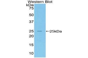 Detection of Recombinant Bax, Mouse using Polyclonal Antibody to Bcl2 Associated X Protein (Bax) (BAX Antikörper  (AA 1-158))