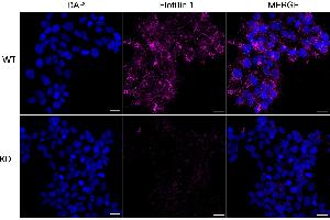 Immunocytochemical staining of HeLa cells using Flotillin 1 antibody (ABIN7798631), 1:1,000), Top panel: wild-type (WT), Bottom panal: Flotillin 1 shRNA knockdown (KD). (Rekombinanter Flotillin 1 Antikörper)