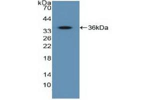 Detection of Recombinant IGF2R, Human using Polyclonal Antibody to Insulin Like Growth Factor 2 Receptor (IGF2R) (IGF2R Antikörper  (AA 2167-2442))