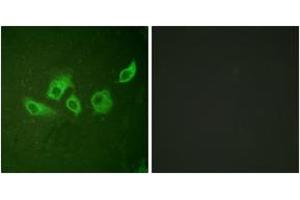 Immunofluorescence analysis of HuvEc cells, using CrkII (Phospho-Tyr221) Antibody. (Crk Antikörper  (pTyr221))