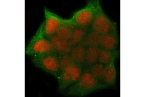 IF analysis of UHRF1 using anti-UHRF1 antibody (ABIN7602109) and anti-Tubulin Alpha antibody (ABIN7600339).