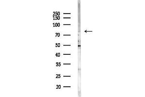 Western blot analysis of lysates from EC304 cells(heat-shock,45 min treatment), using TBX 2/3 Antibody at 1/1000 dilution. (TBX2/3 Antikörper)