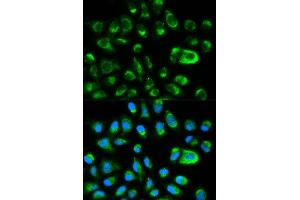 Immunofluorescence analysis of HeLa cell using GAS2 antibody. (GAS2 Antikörper  (AA 1-100))