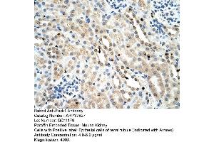 Mouse Kidney (Foxk1 Antikörper  (C-Term))