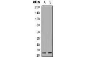 Western blot analysis of CMTM4 expression in Hela (A), A431 (B) whole cell lysates.