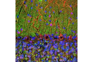 Confocal image of adult rat cerebellum stained with ABIN1580472 (green), ’s chicken polyclonal antibody to MAP2 CPCA-MAP2 (red) and DNA (blue). (VSNL1 Antikörper)