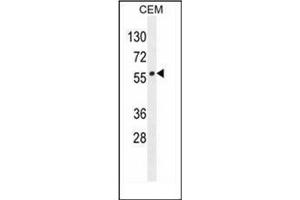 Western blot analysis of LIPC / Hepatic lipase Antibody (N-term) in CEM cell line lysates (35ug/lane).