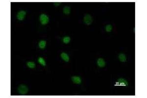 Immunostaining analysis in HeLa cells. (DHX38 Antikörper)