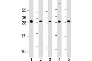 Western blot testing of human 1) SK-BR-3, 2) HeLa, 3) HCT116, 4) MCF-7 and 5) HL-60 cell lysate with NAA10 antibody at 1:2000. (NAA10 Antikörper  (AA 135-167))
