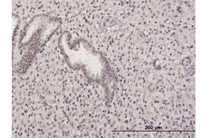 Immunohistochemistry (Formalin-fixed Paraffin-embedded Sections) (IHC (fp)) image for anti-GA Repeat Binding Protein, beta 1 (GABPB1) (AA 1-395) antibody (ABIN515891)