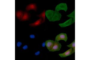 ABIN6256178 and ABIN6267536 staining Hela cells by IF/ICC.