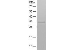 Western Blotting (WB) image for ARP8 Actin-Related Protein 8 Homolog (ACTR8) (AA 1-329) protein (His tag) (ABIN7121895)