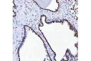 IHC analysis of DDX1 using anti-DDX1 antibody (ABIN7602050).