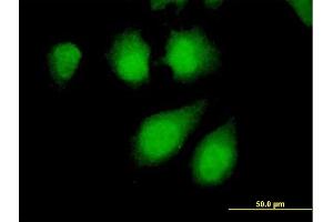 Immunofluorescence of purified MaxPab antibody to PPP2R4 on HeLa cell. (PPP2R4 Antikörper  (AA 1-323))