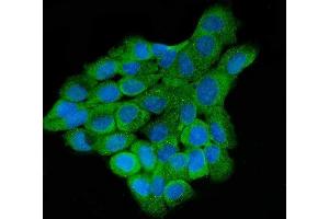 IF analysis of LARP4B using anti-LARP4B antibody (ABIN7600865).
