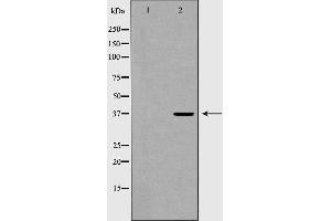 Western blot analysis of extracts of 293 , using THPO antibody. (Thrombopoietin Antikörper  (Internal Region))