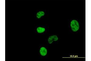 Immunofluorescence of purified MaxPab antibody to NCBP1 on HeLa cell. (NCBP1 Antikörper  (AA 1-790))