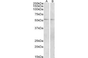 Western Blot (2μg/ml) staining of Mouse (A) and Rat (B) Small Intestine lysate (35μg protein in RIPA buffer).