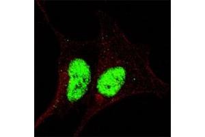 Fluorescent confocal image of SY5Y cells stained with phospho-Sox2 antibody at 1:200.