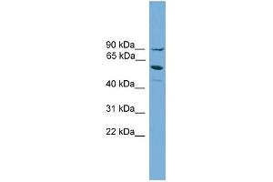 WB Suggested Anti-ALOX15B Antibody Titration:  0. (ALOX15B Antikörper  (Middle Region))