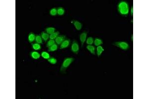 Immunofluorescent analysis of PC-3 cells using ABIN7161848 at dilution of 1:100 and Alexa Fluor 488-congugated AffiniPure Goat Anti-Rabbit IgG(H+L)
