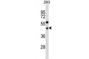 Western Blotting (WB) image for anti-Cyclin G2 (CCNG2) antibody (ABIN2998927) (Cyclin G2 Antikörper)