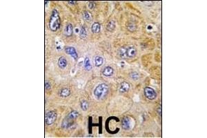 Immunohistochemistry (Paraffin-embedded Sections) (IHC (p)) image for anti-CD90 (THY1) (AA 36-65), (N-Term) antibody (ABIN388803)