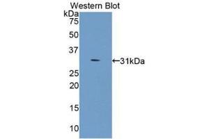 Western Blotting (WB) image for anti-Collagen, Type IV, alpha 5 (COL4A5) (AA 1461-1685) antibody (ABIN3201692) (COL4a5 Antikörper  (AA 1461-1685))