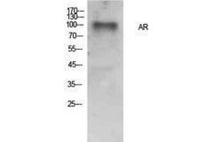 Western Blotting (WB) image for anti-Androgen Receptor (AR) (Internal Region) antibody (ABIN3181394) (Androgen Receptor Antikörper  (Internal Region))
