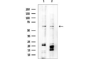 anti-Tigger Transposable Element Derived 1 (TIGD1) (Internal Region) antibody