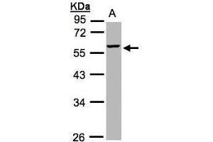 WB Image Sample(30 ug whole cell lysate) A:Hep G2 , 10% SDS PAGE antibody diluted at 1:1000 (MMP3 Antikörper)
