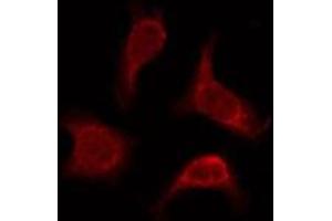 ABIN6276077 staining Hela by IF/ICC. (OR2AP1 Antikörper  (C-Term))