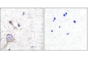 Immunohistochemistry (IHC) image for anti-S100 Calcium Binding Protein A1 (S100A1) (N-Term) antibody (ABIN1848767) (S100A1 Antikörper  (N-Term))