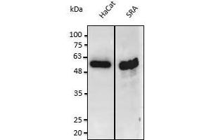 Anti-PS3 Ab at 1/2,500 dilution: lysates at 50 µg of total protein per Iane, rabbit polyclonal to goat lgG (HRP) at 1/10,000 dilution, (p53 Antikörper  (C-Term))
