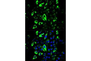 Immunofluorescence (IF) image for anti-Granzyme B (GZMB) antibody (ABIN1875446) (GZMB Antikörper)