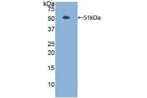 Detection of Recombinant PKM2, Human using Polyclonal Antibody to Pyruvate kinase isozymes M2 (PKM2) (PKM2 Antikörper  (AA 294-470))
