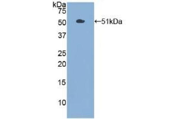 PKM2 Antikörper  (AA 294-470)
