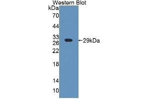Western blot analysis of the recombinant protein. (ART4 Antikörper  (AA 51-275))