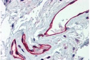 Human Colon, Vessels (formalin-fixed, paraffin-embedded) stained with DARC antibody ABIN337034 at 2. (DARC Antikörper  (C-Term))
