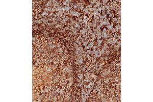 Immunohistochemical analysis of paraffin-embedded human tonsil tissue using (ABIN657755 and ABIN2846737) performed on the Leica® BOND RXm. (HLA-DPB1 Antikörper  (AA 77-105))
