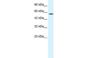 WB Suggested Anti-MEIS2 Antibody Titration:  1. (MEIS2 Antikörper  (N-Term))