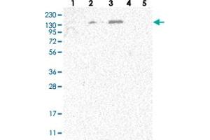 Western blot analysis of Lane 1: RT-4, Lane 2: U-251 MG, Lane 3: Human Plasma, Lane 4: Liver, Lane 5: Tonsil with SPOCD1 polyclonal antibody  at 1:250-1:500 dilution. (SPOCD1 Antikörper)